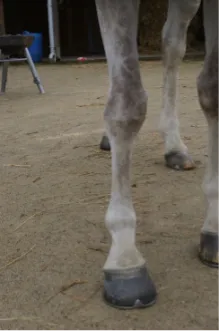Combinaison de déviation, genoux offset, varus du doigt antérieur gauche, avec un pied cagneux