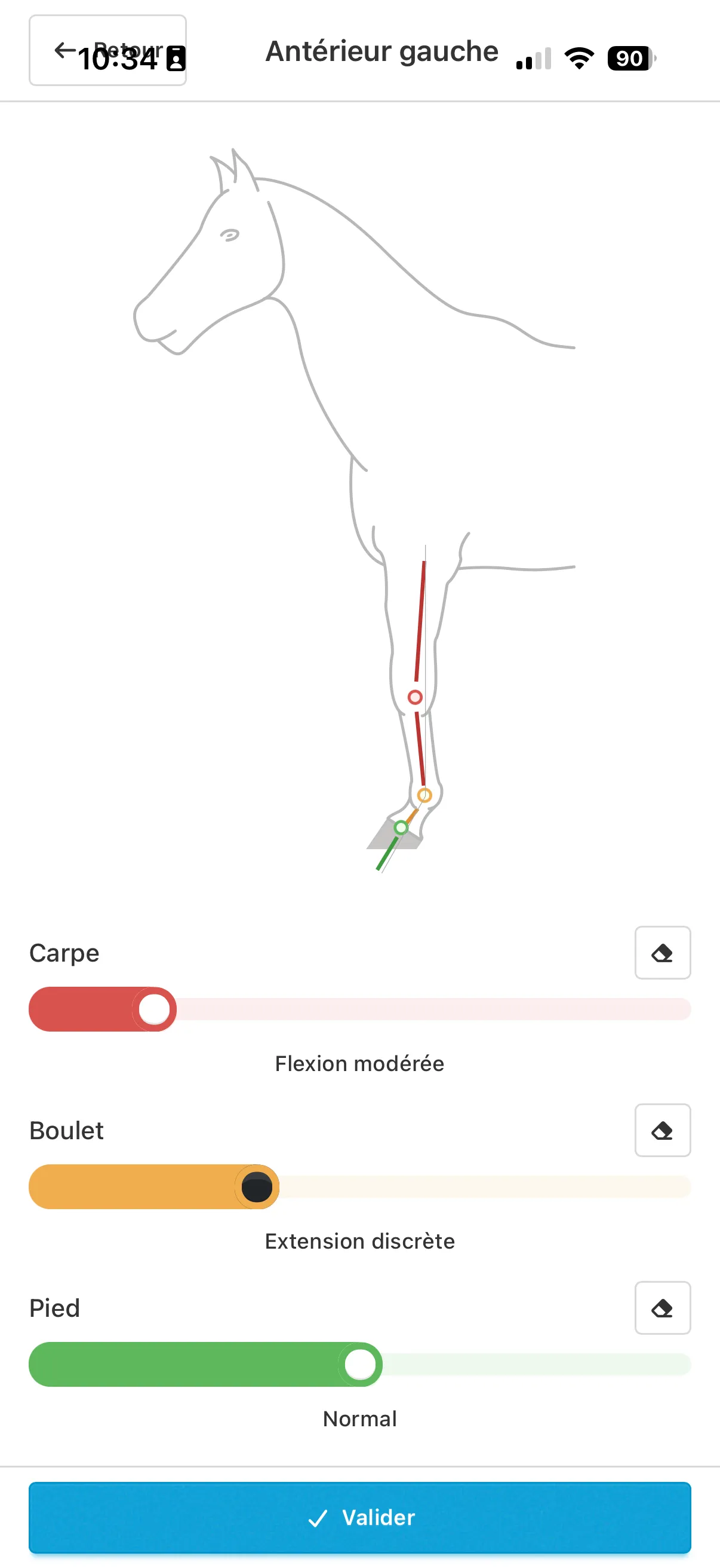 Déviation sagittale